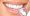 What To Expect During The Dental Veneers Treatments