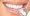 What To Expect During The Dental Veneers Treatments