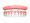 All On 4 Dental Implants