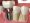 dental_implant