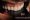 dental-crown