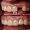 Single Dental Crown