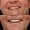 Snowdrop Dental Veneers