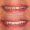 Snowdrop Dental Veneers