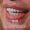 Snowdrop Smile Makeover
