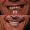 Snowdrop Smile Makeover