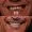 Snowdrop Smile Makeover