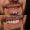Snowdrop Smile Makeover