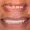 Zirconium Crowns For Upper Teeth