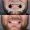 Snow White Veneers